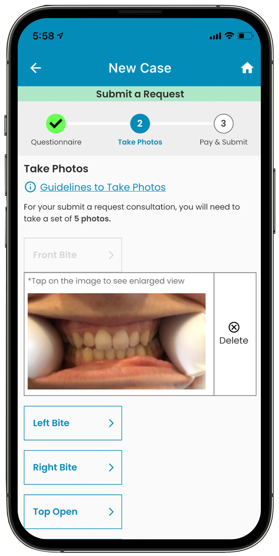 DigiBite teledentistry app uploading photos for a dental consultation request screen